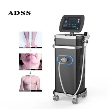 ADSS High Power Exchangeable Spot Size Diode Laser 755 808 940 1064 4 Wavelengths Ice Diode Laser Hair Removal Machine