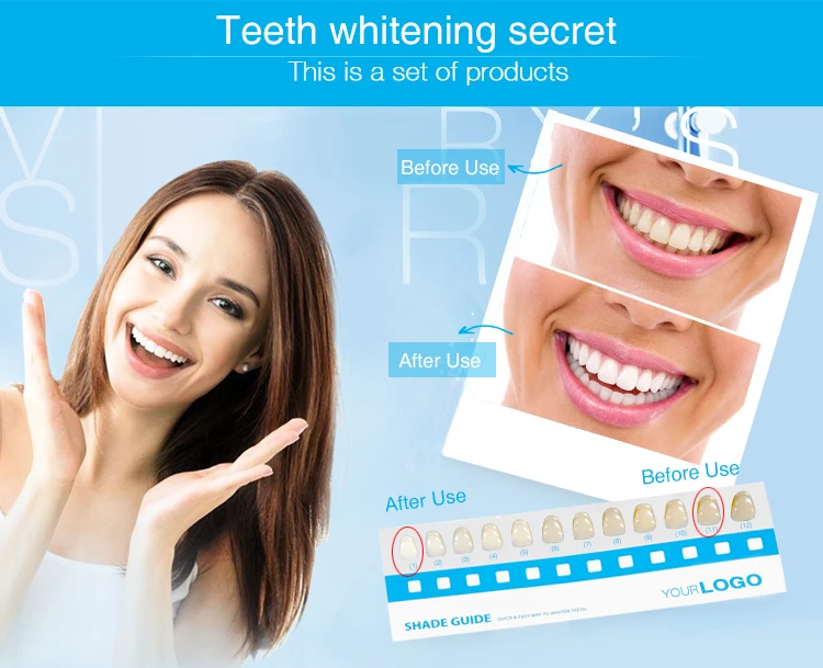 Onuge Professional Clinic Use Teeth Whitening Gel Kit Private Label