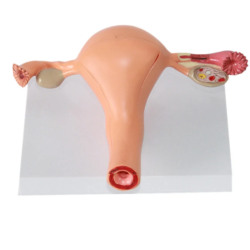 Human Uterus Model Ovarian Reproductive Structure Uterine Pathological ...