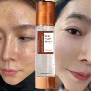 OEM ODM Service Face Care Improving Skin Elasticity Hydrating 96% Snail Mucin Serum