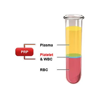 PRP