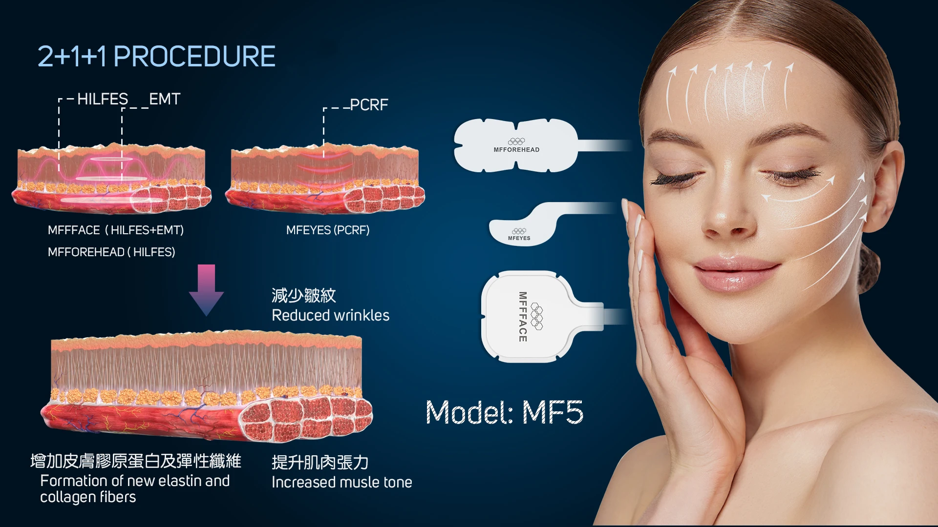 Professional 3 In 1 Ems Rf Face Muscle Full Facial Lifting Remove