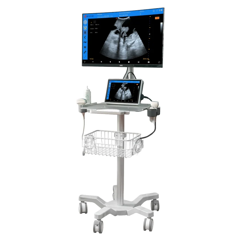 ECI-E7 Pet Doppler Ultrasound Diagnostic System With 27inch Screen 128 Elements 32 Channels 4 Different Probes for Dog CatLizard
