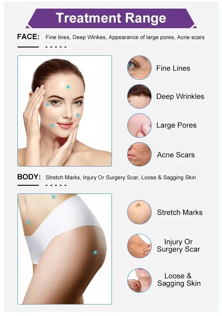 Facial Radio frequency vacuum rf Skin Tightening Rf Microneedling Machine