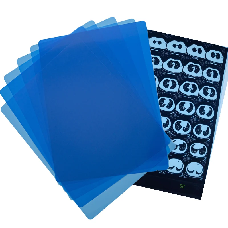 High Quality 35x43 Inkjet Blue Medical X Ray Film For Epson Digital X-ray Film For CT
