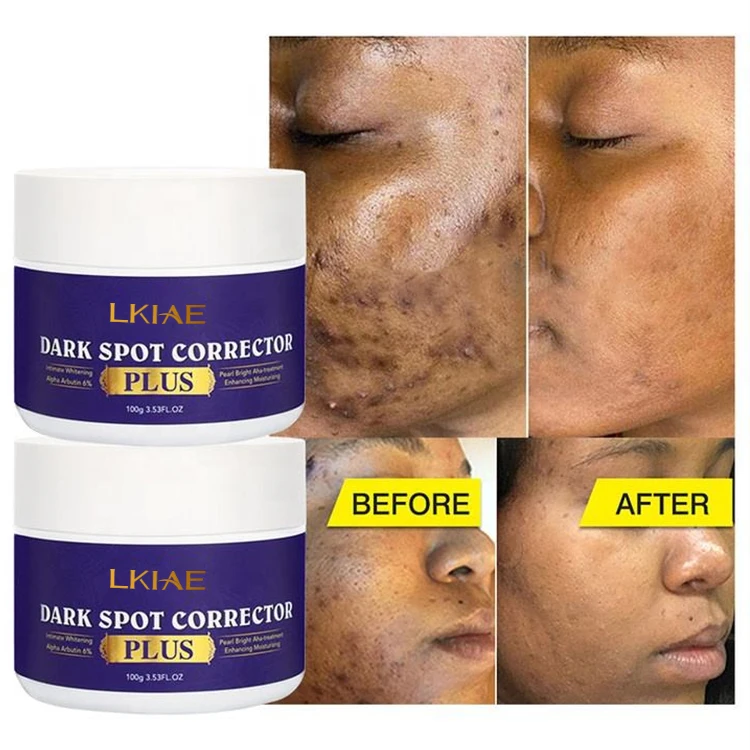 glutathione plus cream Amazon.com: Gluta-C with KOJIC PLUS Face and Neck Cream : Beauty & Personal  Care main image 0