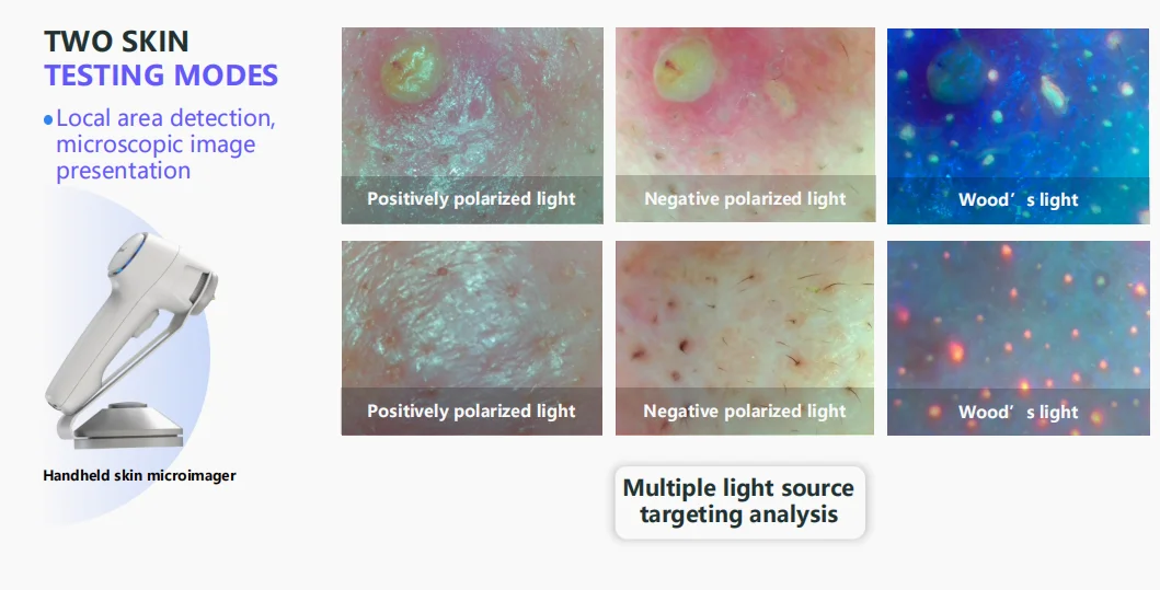 Diagnostic Microimager
