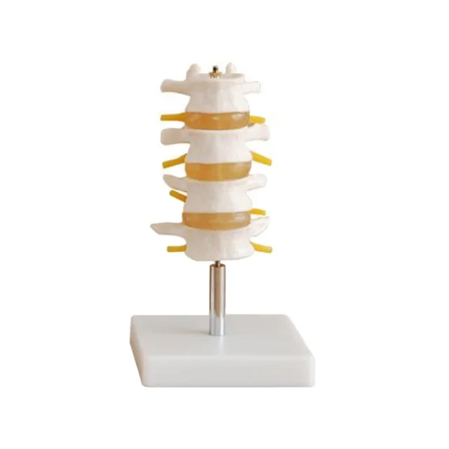 DARHMMY   Human Lumbar Spine Model, 4 Vertebrae Sections with Nerves & Herniated Disc, for Medical Teaching Anatomy Study