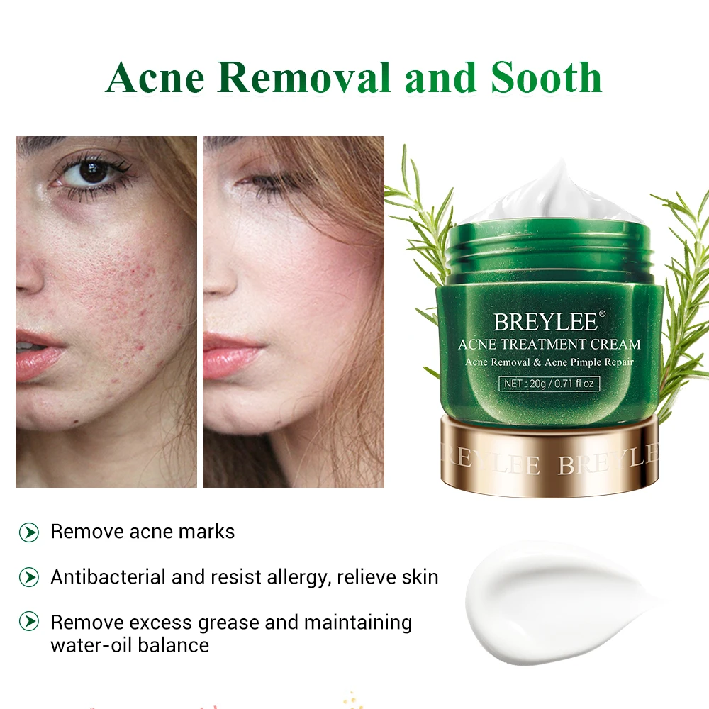 BREYLEE OEM Tea Tree Essential Oil Acne Skin Care Set Anti Acne Face Cream Acne Removal Serum