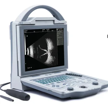 ophthalmological A/B ultrasound scanner A scan B scan prob measuring ACD lens vitreous body AL