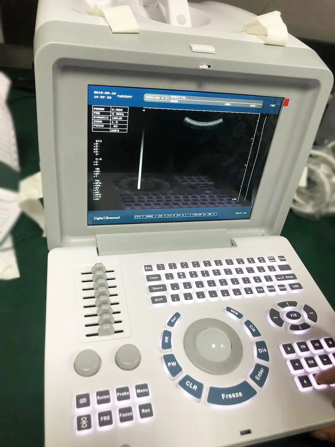 LTUB61 Tabletop medical full digital 10.4 inch LED human pregnancy ultrasound machine portable