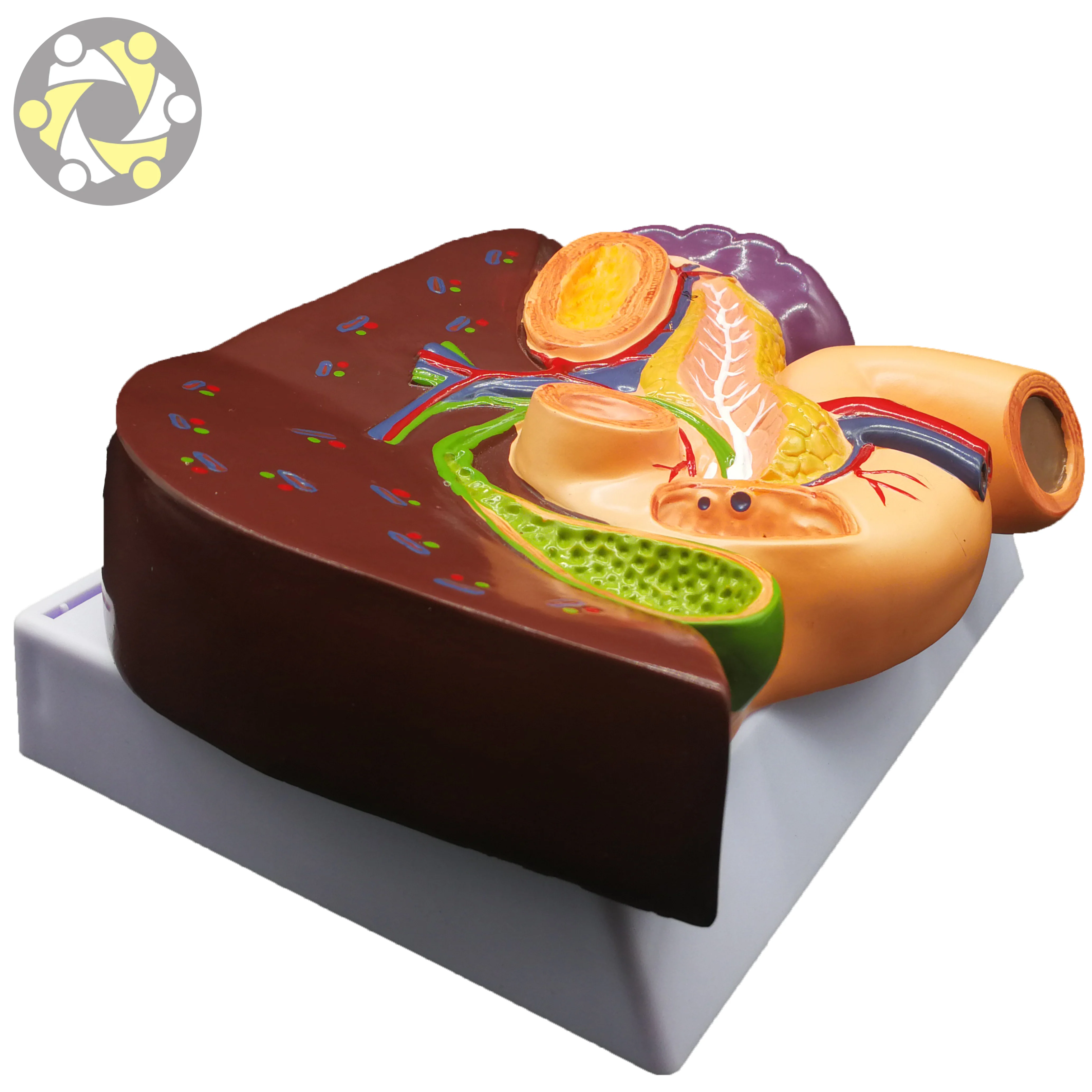 Science Medical Teaching Liver Pathology Model With Duodenum Stomach