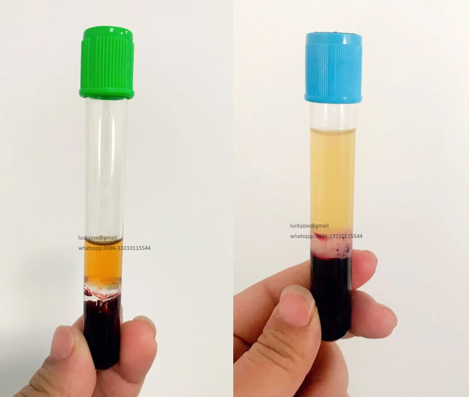 Hospital Disposable Prp Collection Tube Buy Prp Collection Tube,Prp