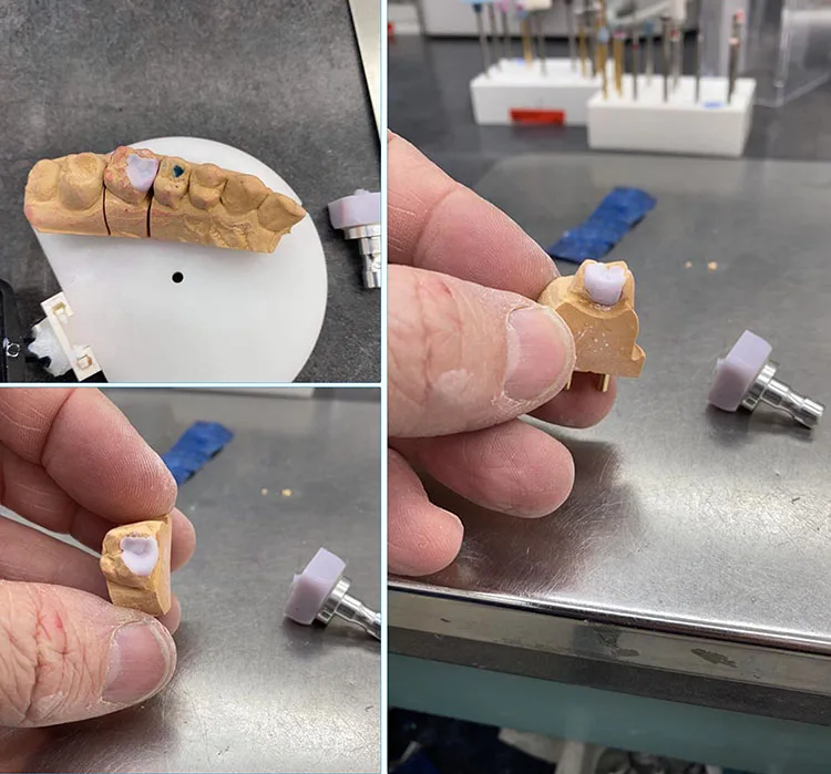Pressing of CAD/CAM Blocks Made of Lithium Disilicate