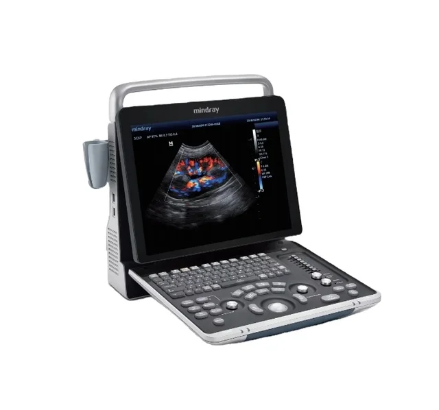 Portable Mindray z60 Vet Ultrasound Diagnostic Machine with Rechargeable Battery for Vet Clinic