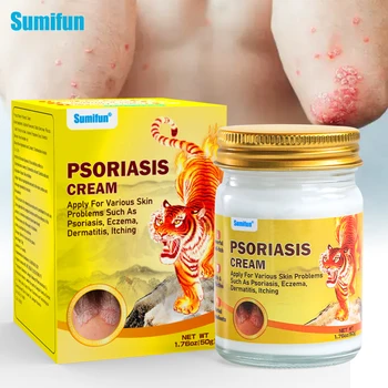 Sumifun 50g Psoriasis Ointment Dermatitis Scrotum Eczema Psoriasis Skin Care Cream