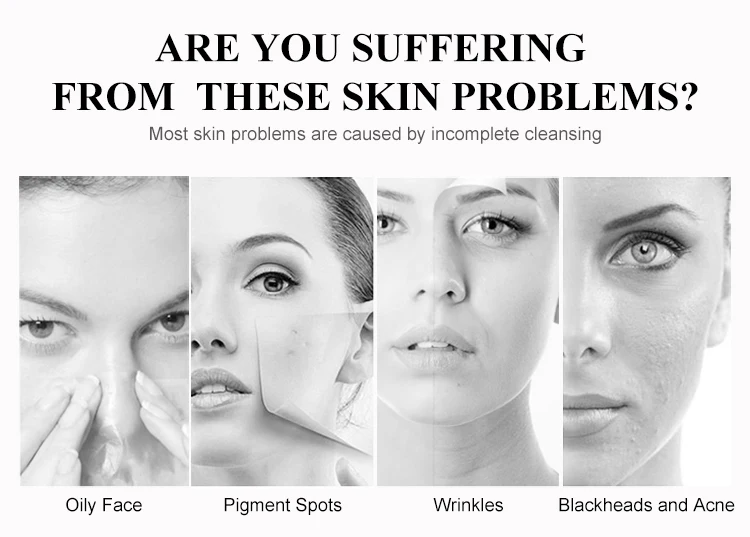 Ultrasonic Face Dead Skin Scrubber Pore Blackhead Removal Cleaning