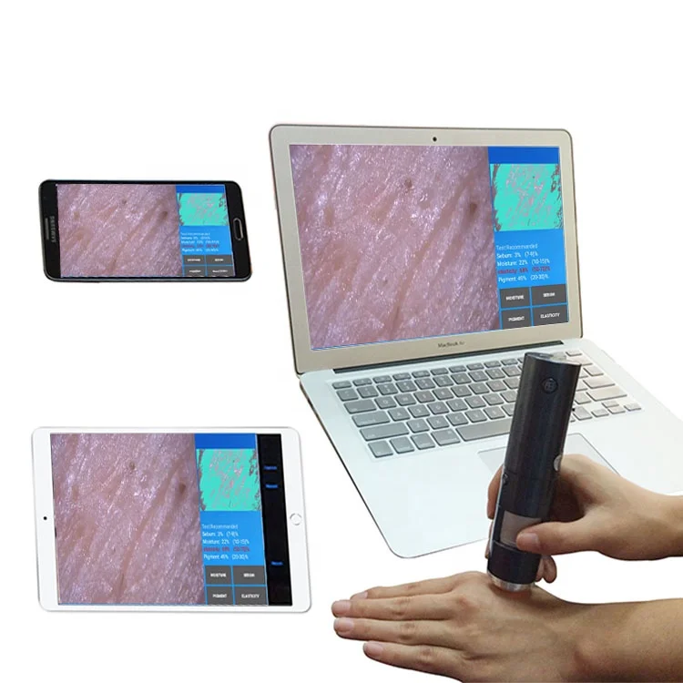 Professional Wireless Wifi Smart Scalp Skin Detector Mini Skin and Hair Analyzer Analyze