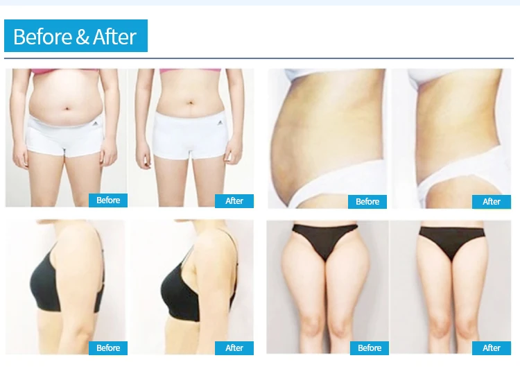 Popular 5D/8D inner ball roller slimming machine cellulite massage 360 rolling detox body slimming machine LF-174