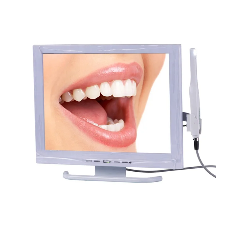 Intra Oral Wireless Camera Scanner for Mobile Phones