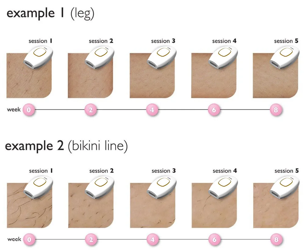Facial Lazer Epilator Hair Removal Appliances Portable Diode Laser Hair