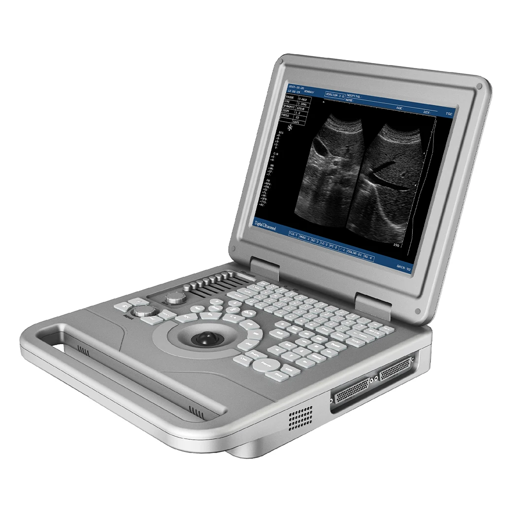 Hospital Handheld Obstetric Ultrasound Device Portable PC Platform B/W Ultrasound Scan Machine