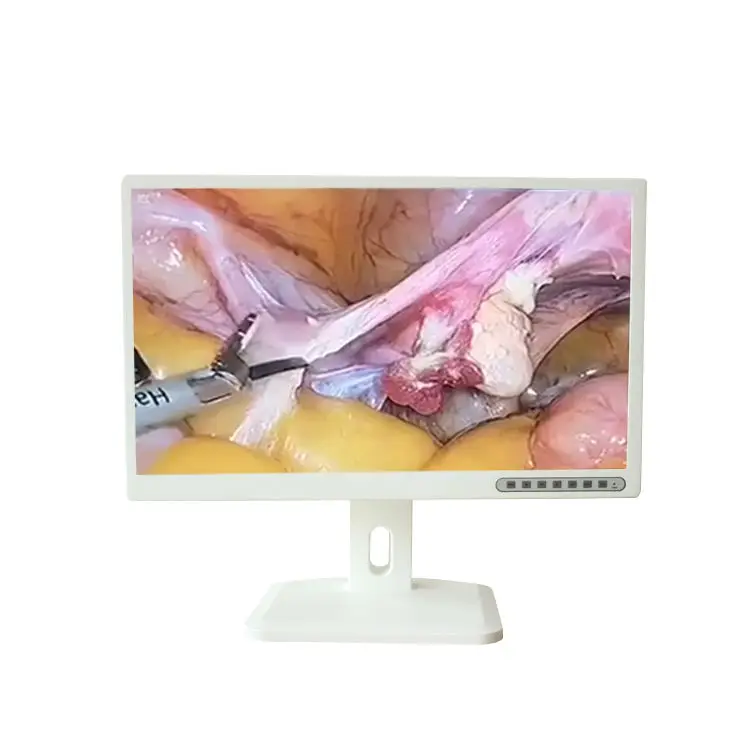 HD 1080P Video Camera medical endoscopy camera module Endoscope System for Ent details