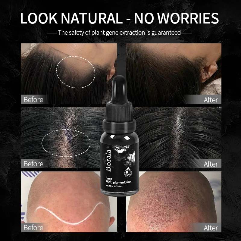 Scalp Micropigmentation Ink Factory Price of SMP Tattoo Pigments Micro Pigmentation Hair Permanent Makeup Pigment