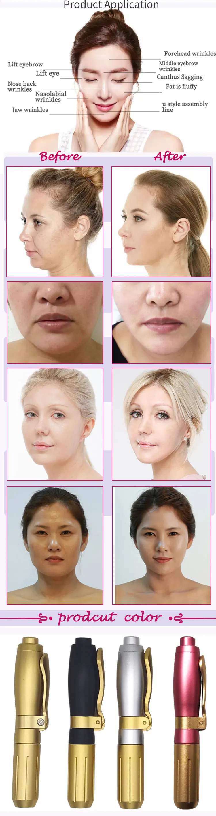 hyaluronic pen test