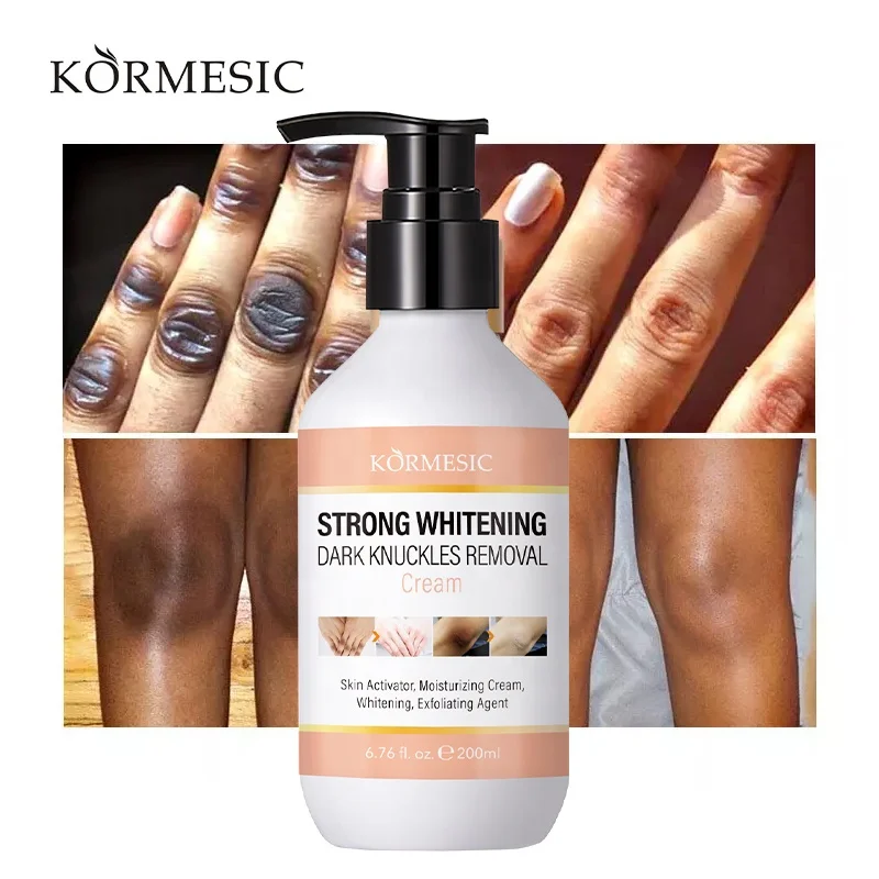 OEM KORMESIC Private Label Dark Knuckles Fast Whitening Serum Hand Knuckle Elbows Knee Intense Stains Remover Serum