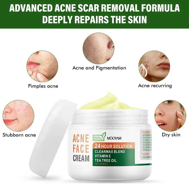 tea tree oil acne scars