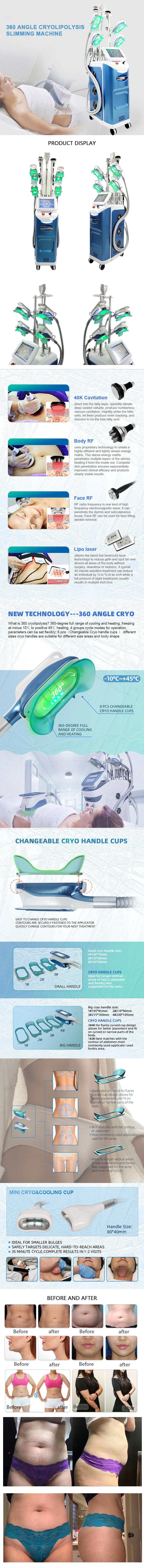 Portable Cryolipolisis Fat Freezing Machine With Lipolaser Cavitation Rf