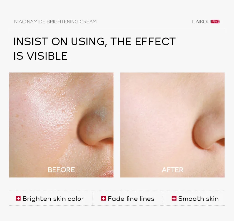 LAIKOU Skin Care Moisturizing Nourishing Firming Niacinamide Whitening Brightening Face Cream 30g