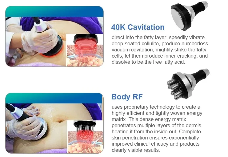 Аппарат для снижения веса cryo 360, технология cool tech, снижение жира, замораживание тела, скульптурная машина для похудения для удаления всего тела, сложное удаление жира