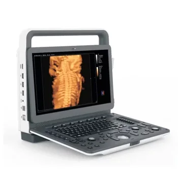 Zoncare M30 Color Doppler Ultrasound Diagnostic System M30 Portable ultrasound system Used in urology, ward, ultrasound