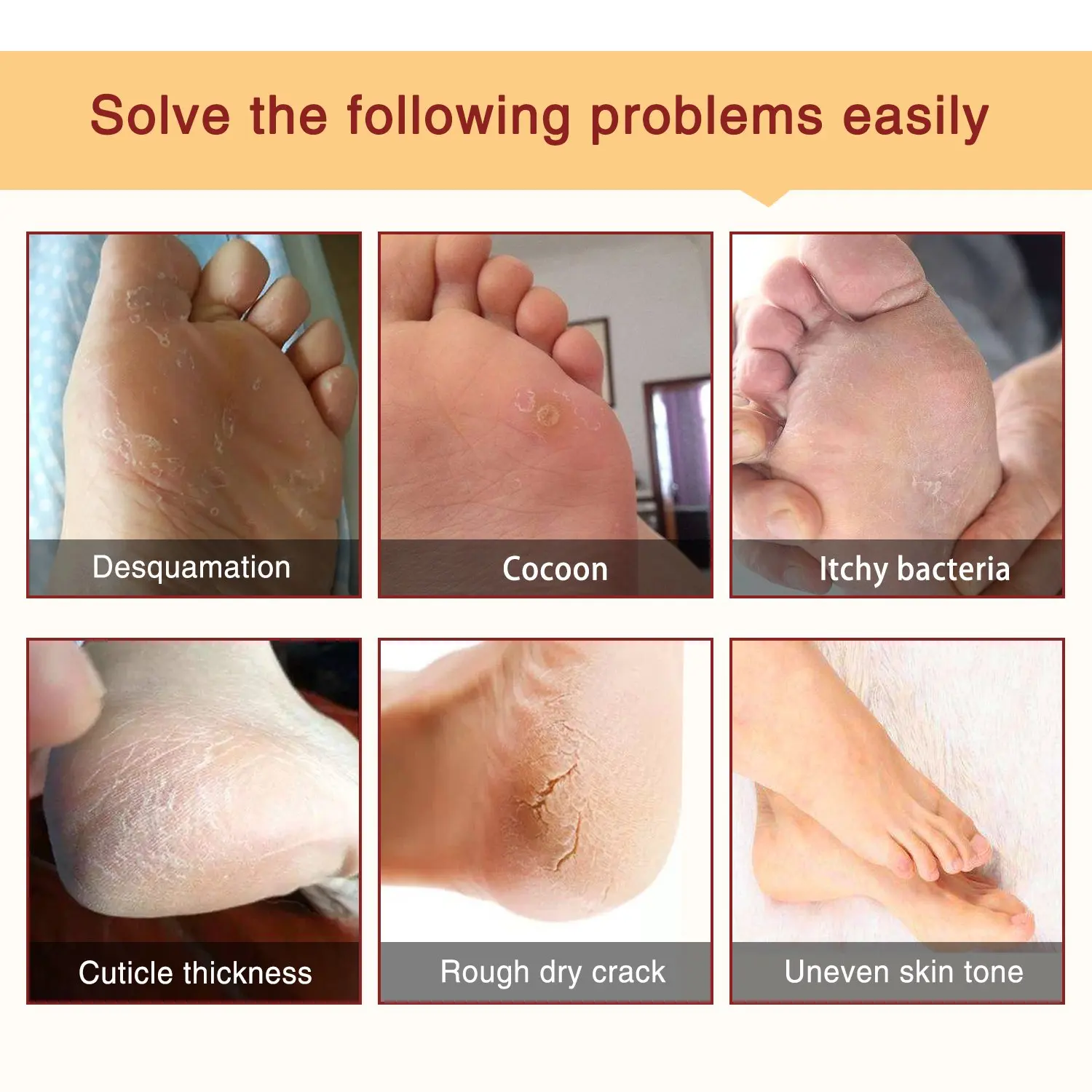 Professional Foot Care Dead Skin Remover – Mavigadget
