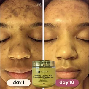 Private Label Exfoliating for Turmeric Face Pad Kojic Acid and Tumeric Cleanser Pads with High Quality for Wholesale