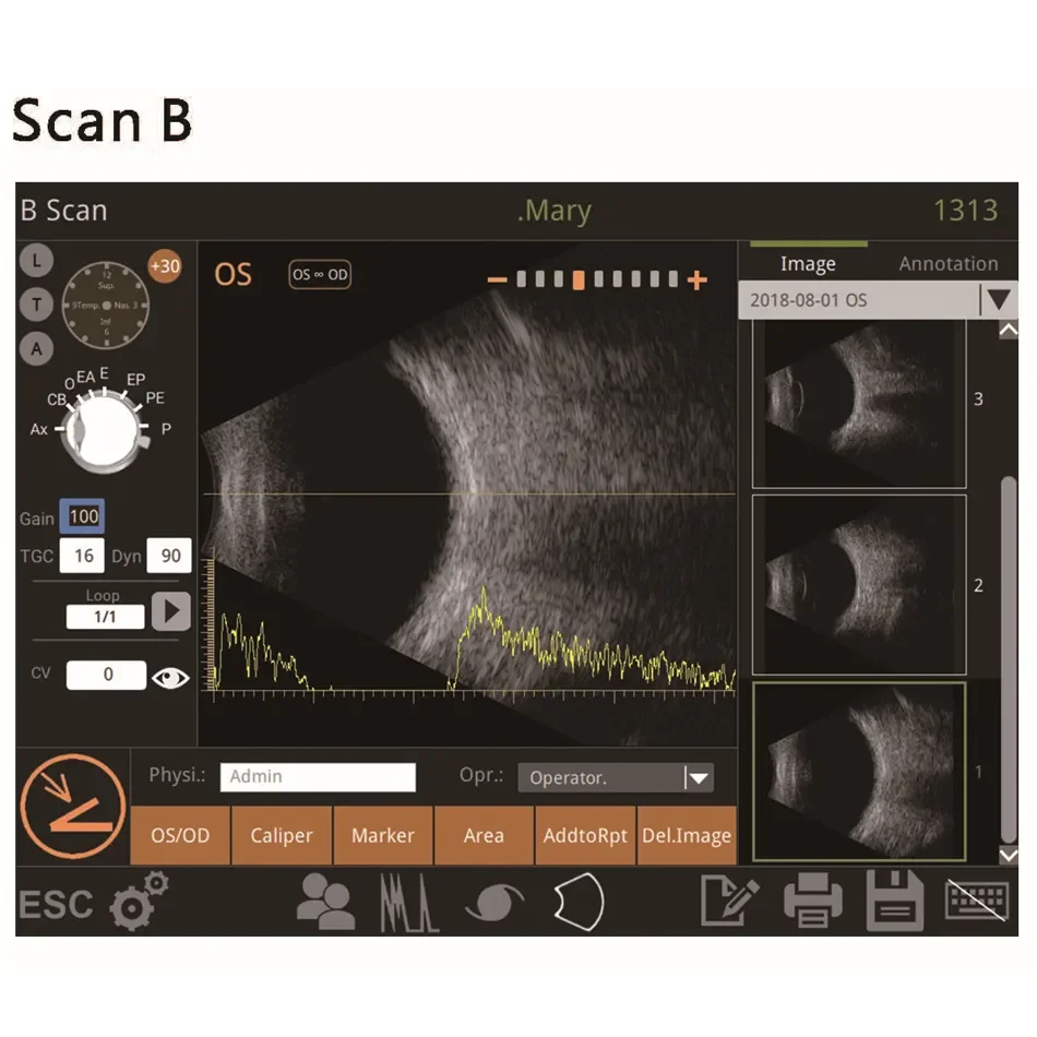 International Medical Certified Ultrasonic Optical Instruments Retiwave-1000 Ophthalmic AB Scan Ultrasound Machine