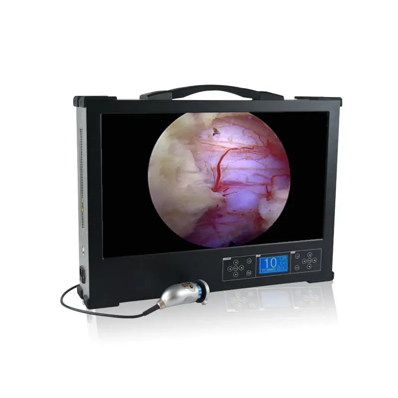 All-in-One Portable Endoscope Camera System professional medical devices 4K Screen with Monitor and Light Source manufacture