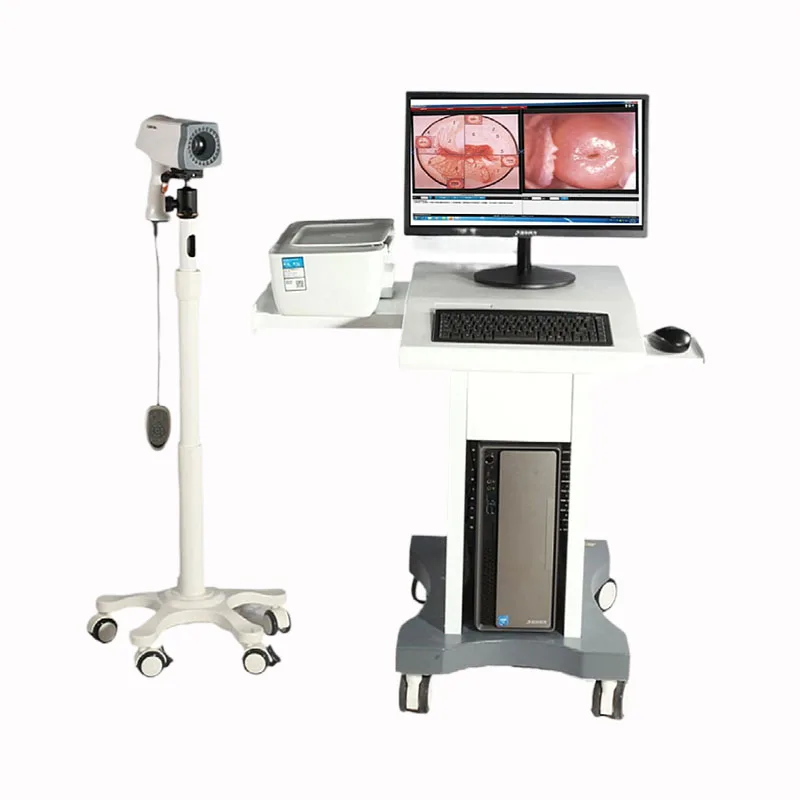 Kernel KN-2200 Hospital Digital Portable Gynecological Colposcope Diagnostic Apparatus Colposcopy Machine for Sale
