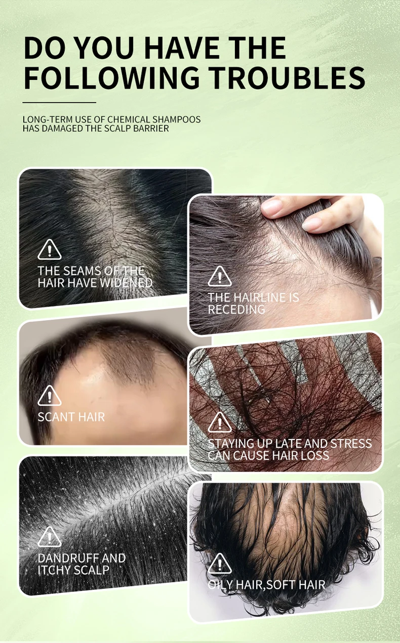 Wholesales Greenlem Usman Grass Soap Hair Care Soap with Platycladus Leaf & Amino Acid Hair Strengthening Usman Grass Soap(pic4)