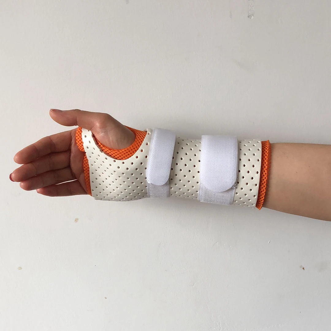 Thermoplastic Orthopedic Splint for Fracture Rehabilitation