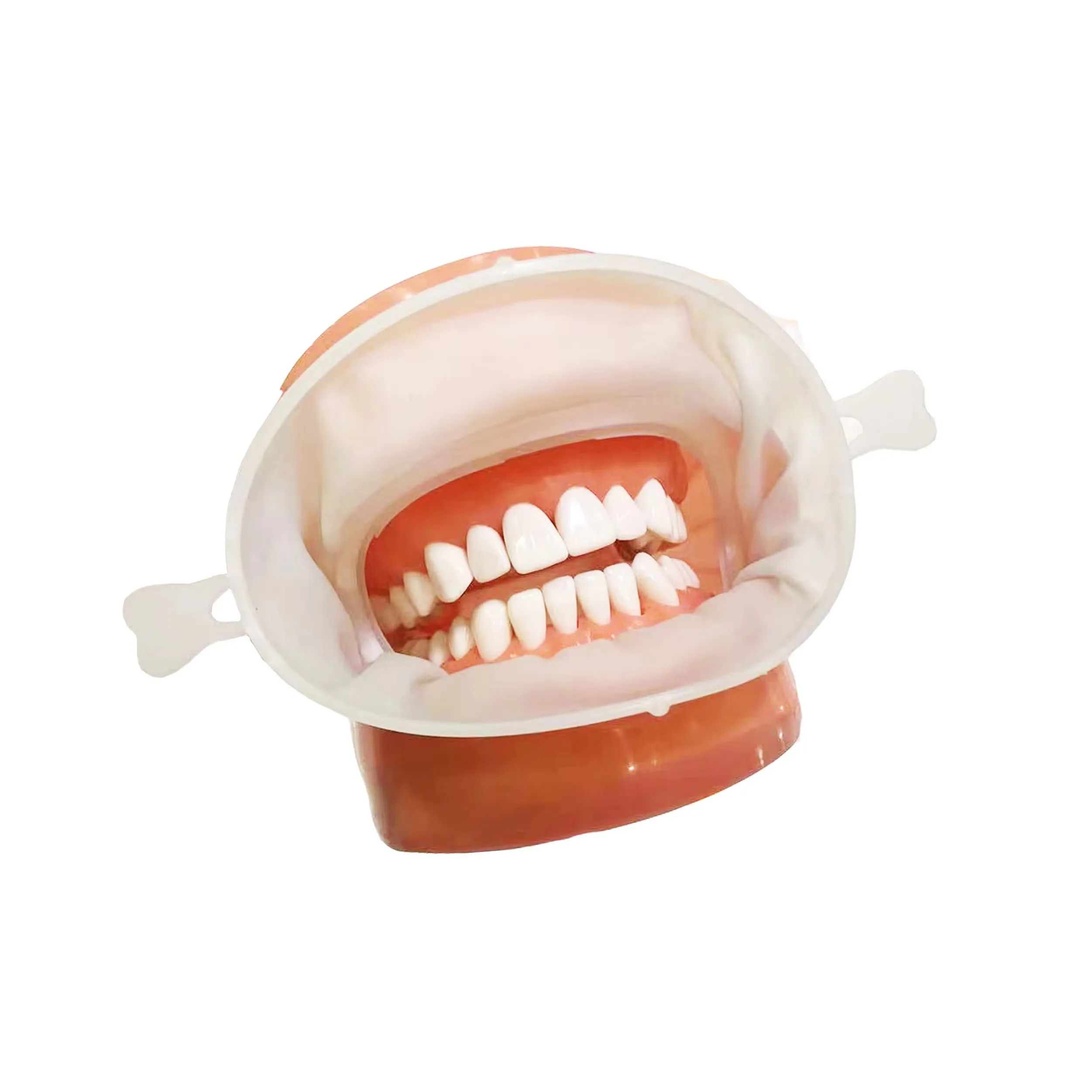 Écarteur Buccal Dentaire OptraGate Junior - Petit Modèle Régulier - Pour Soins Pédiatriques Et Orthodontie