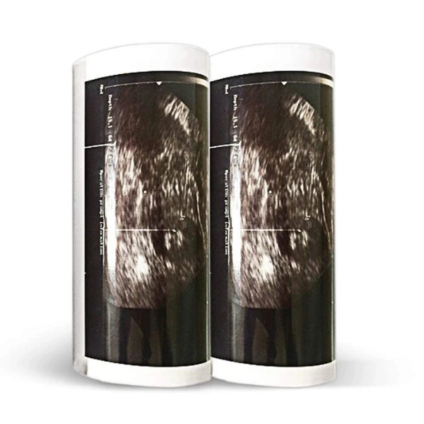 Original High Glossy Type V 110x18m Video Print UPP-110HG Ultrasound Thermal Paper for Sony Printer