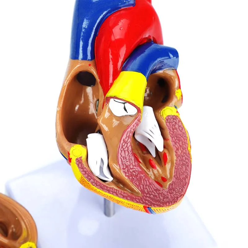 product medical cardiac anatomy human heart model for cardiology ultrasound surgery training-5