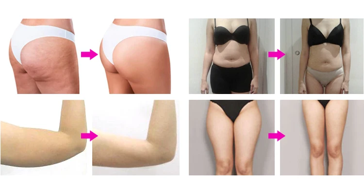Factory G5 Vibrating Body Massager Slimming Machine / G5 device/G5 Vibration Cellulite Fat Loss Machine Cynthia RU 30