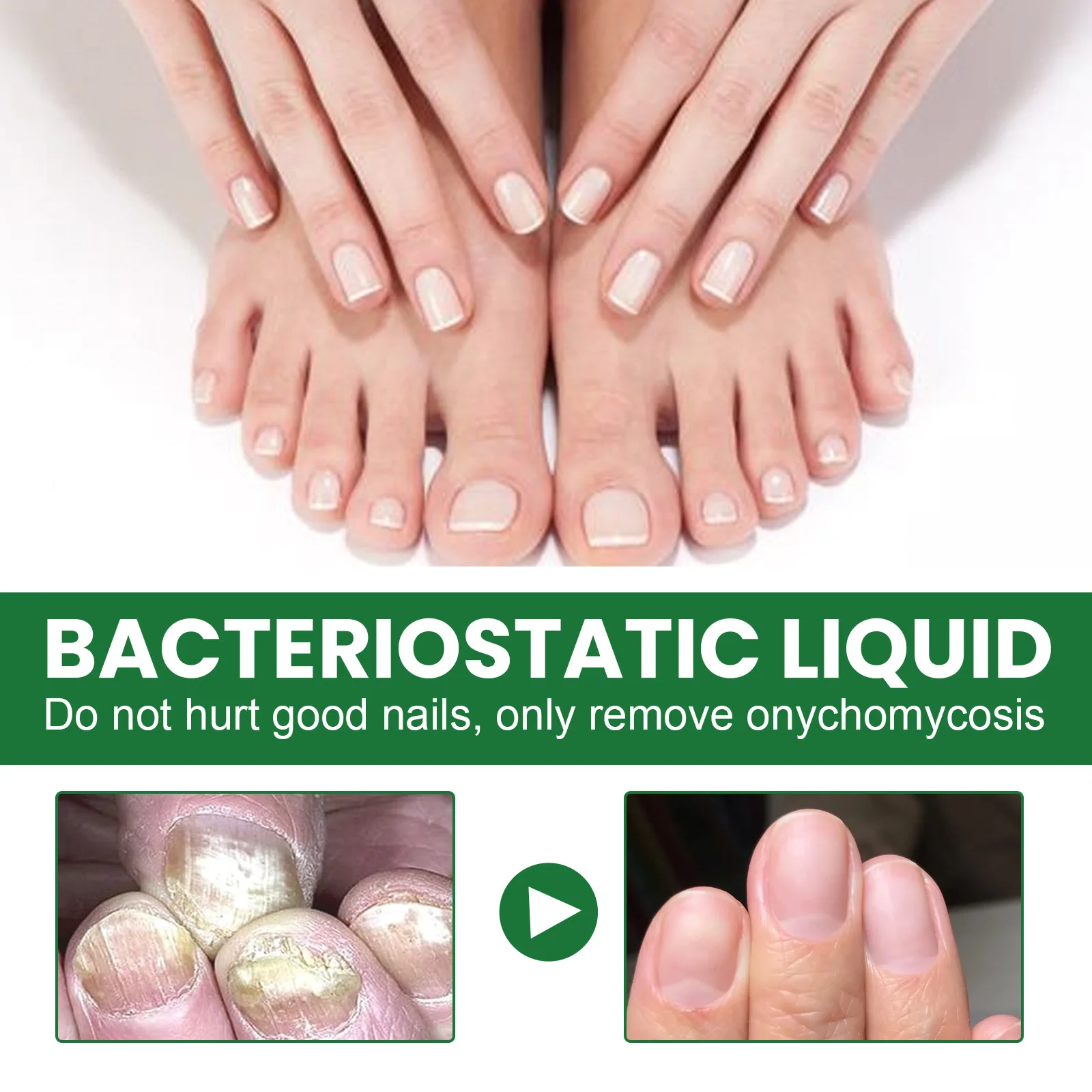 Show your fingernails some TLC. Protect them from fungal infection. -  CHARMS Singapore