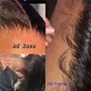 Frontal & Closure