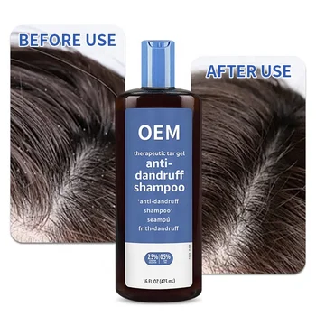 OEM ODM Reduce Dandruff Hair Shampoo Private Label Organic Anti-Itching Anti-Dandruff Shampoo For Hair