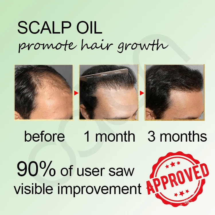 New Arrival Olive Oil Hair Scalp Oil Organic Natural For Hair Growth